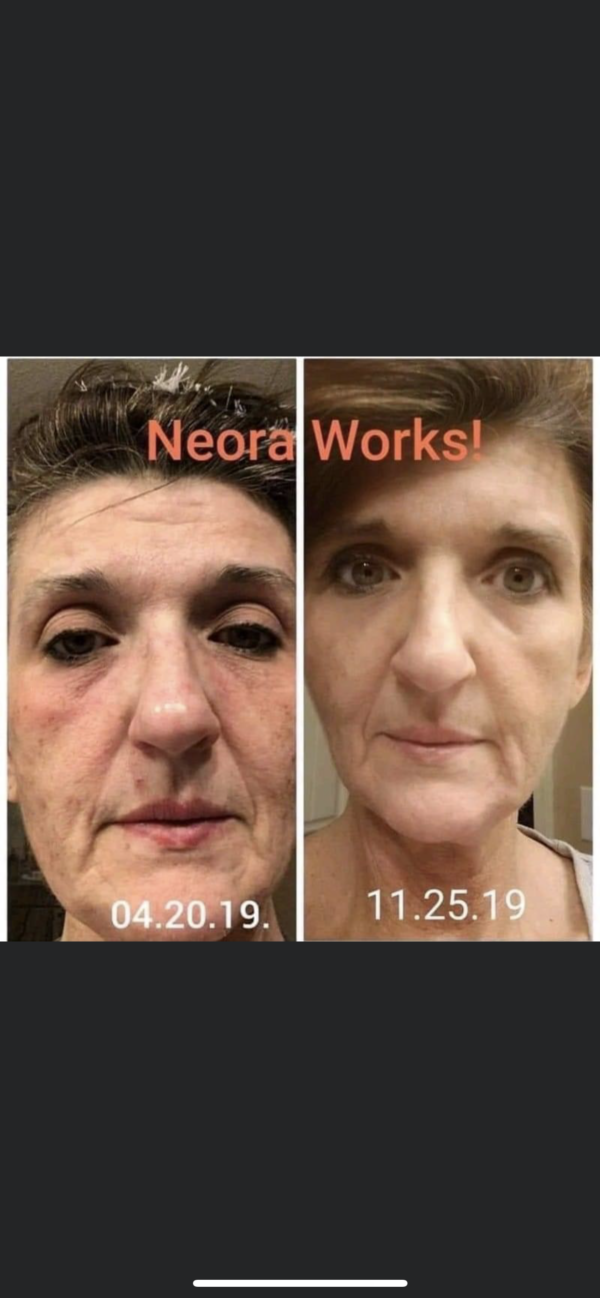 Question: Are you currently using a product or a product range to improve your skin? Are you happy with the results? If you’re not getting the results you want from the products you’re using, try Neora